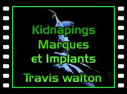 Kidnapings, Marques et Implants - Travis Walton