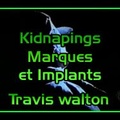 Kidnapings, Marques et Implants - Travis Walton